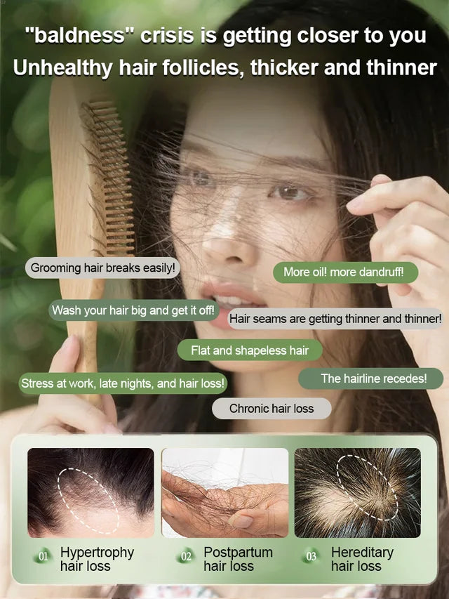 Anti-Hair Loss And Hair Growth Natural Shampoo Bar (BUY 1 GET 1 FREE)