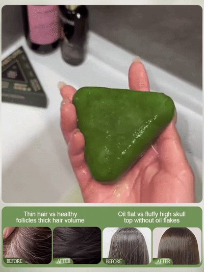 Anti-Hair Loss And Hair Growth Natural Shampoo Bar (BUY 1 GET 1 FREE)