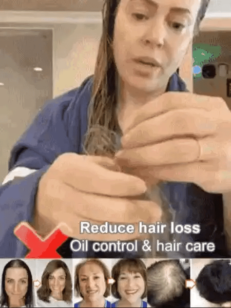 ✨🎁Hot Sale Ginger Plant Extract Anti-Hair Loss Hair Shampoo✨🎁