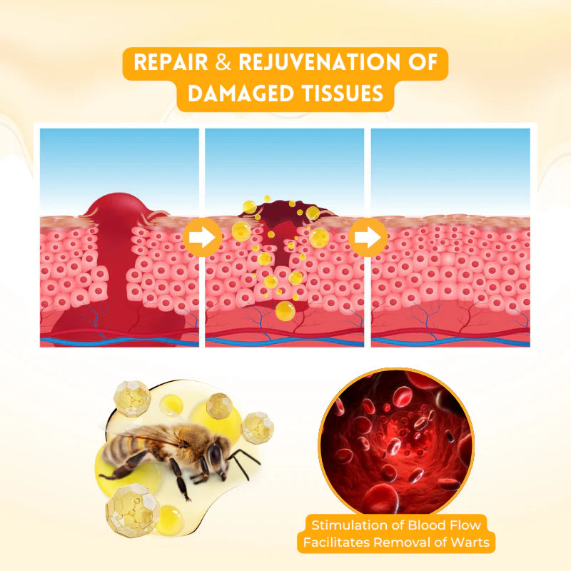 Biancat™ DermRenew Bee Venom Multi-Action Ward Remover Cream