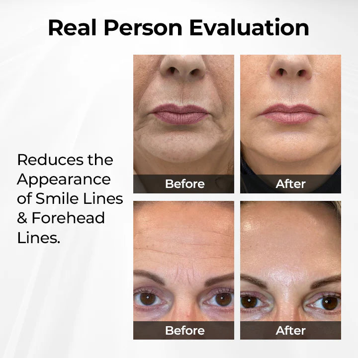 Biancat® TightShift Precision Contour & Firming Serum (BUY 1 GET 1 FREE)