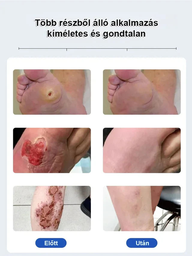 Biancat® VitaGluco Diabetes Treatment Cream (BUY 1 GET 1 FREE)