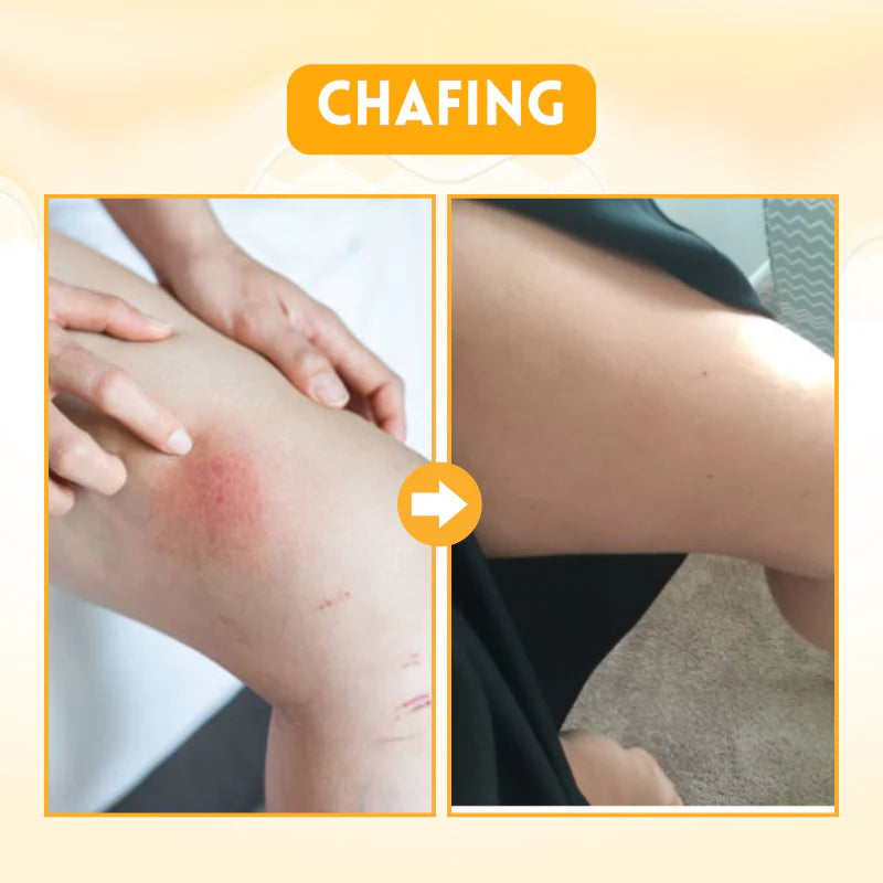 Biancat™ DermRenew Bee Venom Multi-Action Ward Remover Cream