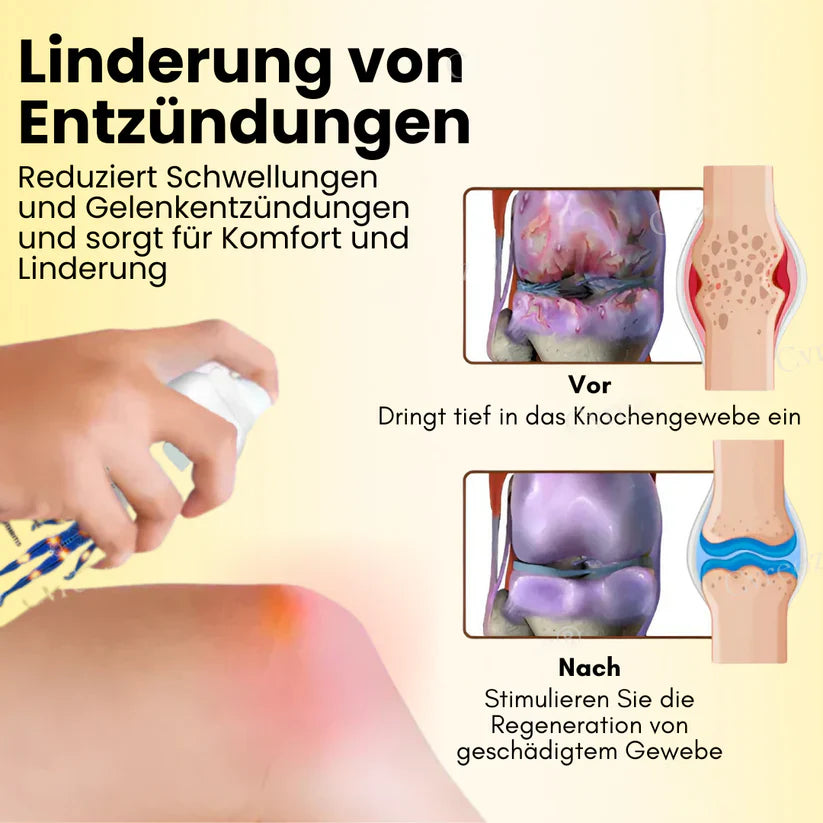 Magnesium Oil & Bee Venom Joint Healing Spray (BUY 1 GET 1 FREE)