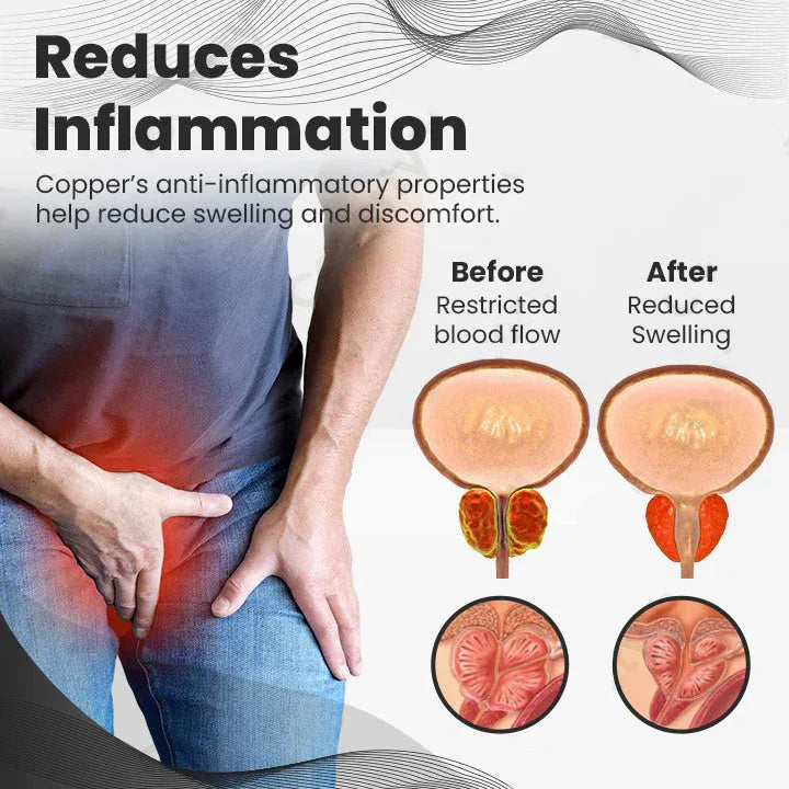 Histone™ CopperMag Prostate Therapy Ring (BUY 1 GET 1  FREE)