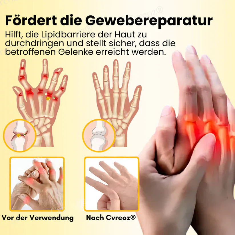 Magnesium Oil & Bee Venom Joint Healing Spray (BUY 1 GET 1 FREE)