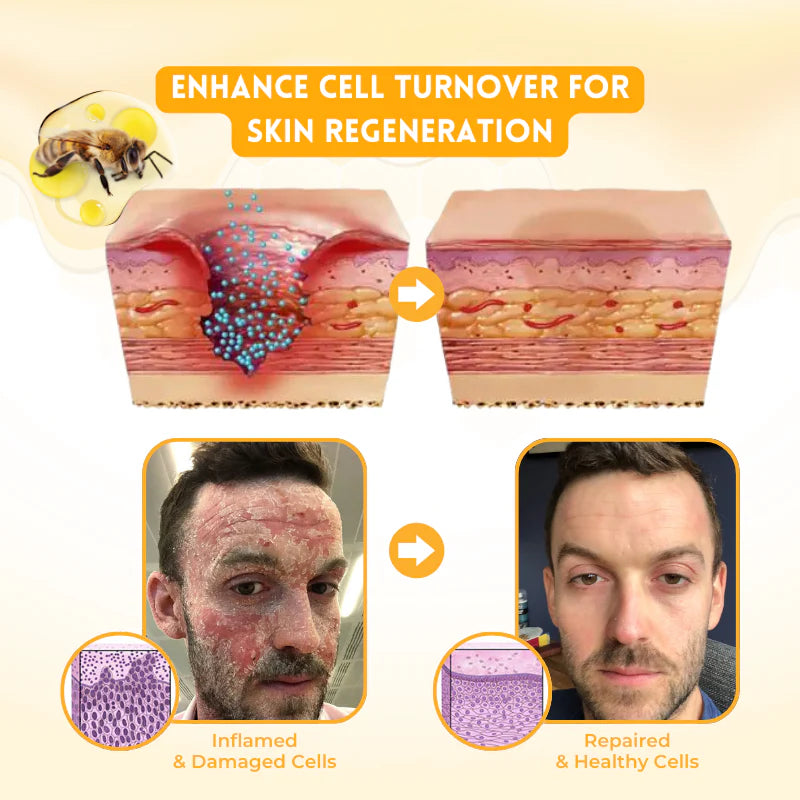 Biancat™ DermRenew Bee Venom Multi-Action Ward Remover Cream