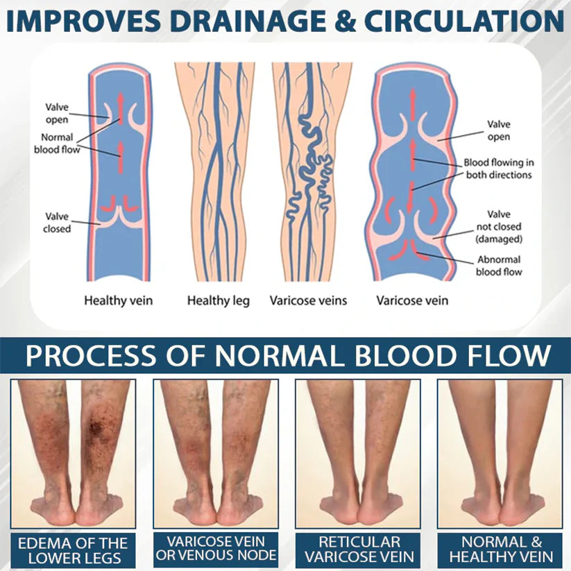 VenoHerb Black Cumin Edema Relief Balm (BUY 1 GET 1 FREE)