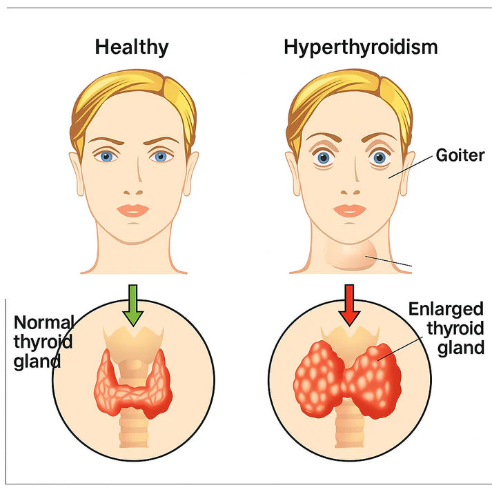 SENJOKO Thyroid Dissolving Cream (BUY 1 GET 1 FREE)