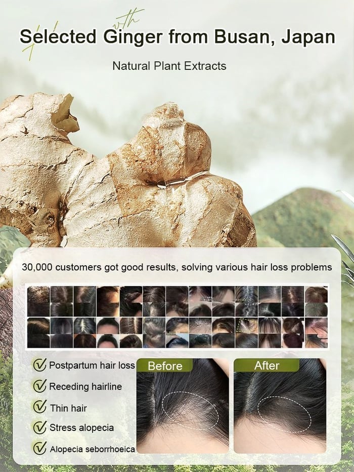 ✨🎁Hot Sale Ginger Plant Extract Anti-Hair Loss Hair Shampoo✨🎁